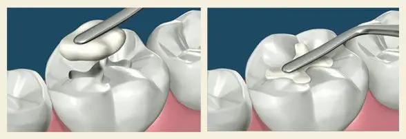 Before treatment
